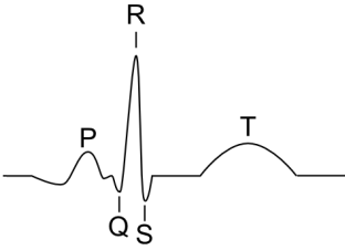 ecg-PQRSTwaves